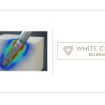 FEM analysis of a tilted implant