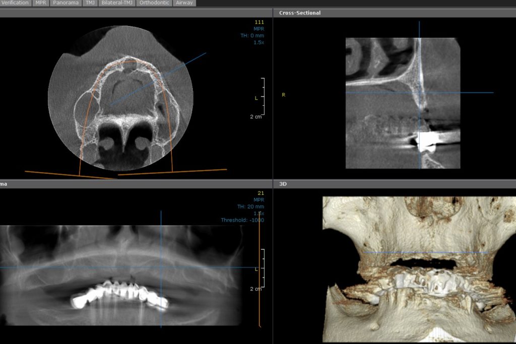 CBCT imaging