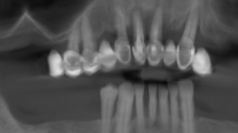 Failing dentition